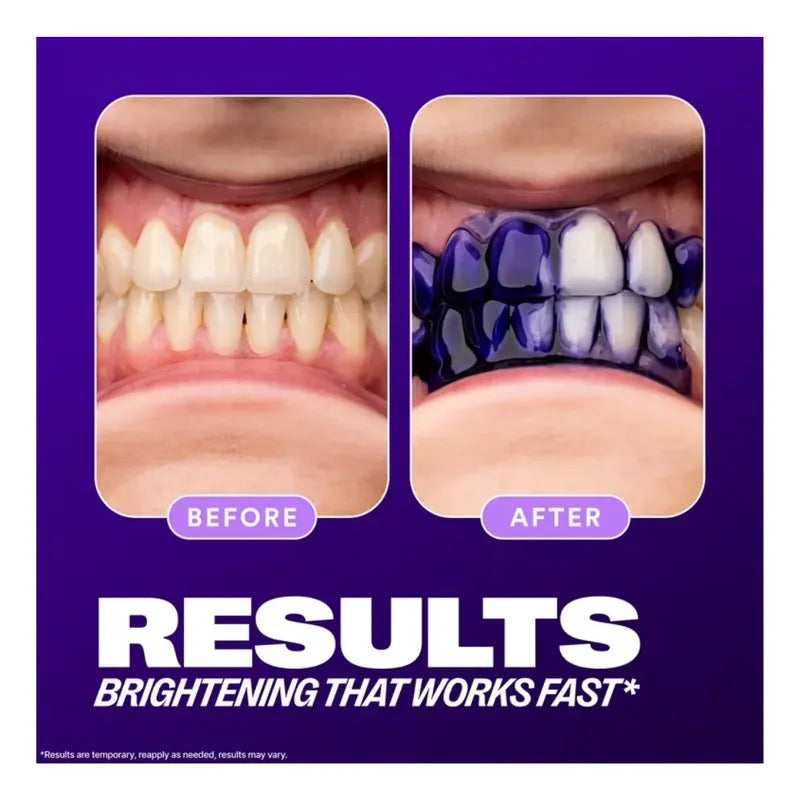 Blanqueador Dental V34 Blanqueamitento Para Dientes Liquido